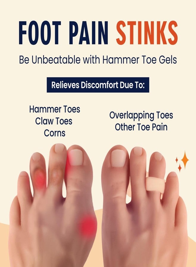 Dr. Frederick's Original Hammer Toe Corrector Gels - 2 Pairs - All-Day Relief for Crooked & Overlapping Toes - Soft Cushioning - Symptomatic Support for Toe Alignment - Beige - 1 Loop Design - Image 2